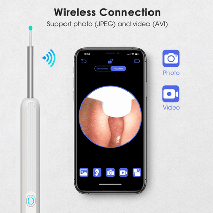 👂Ear Wax Removal with Camera and Light, Ear Wax Removal Kit with 1296P Otoscope