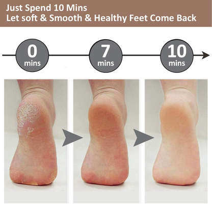 Electric Foot Callus Remover Kit Foot File